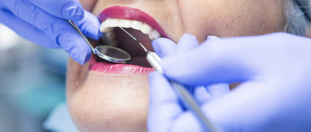 Best Broken or Chipped Tooth Repair in West Frankfort, IL